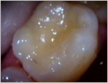 Caroline Dental
